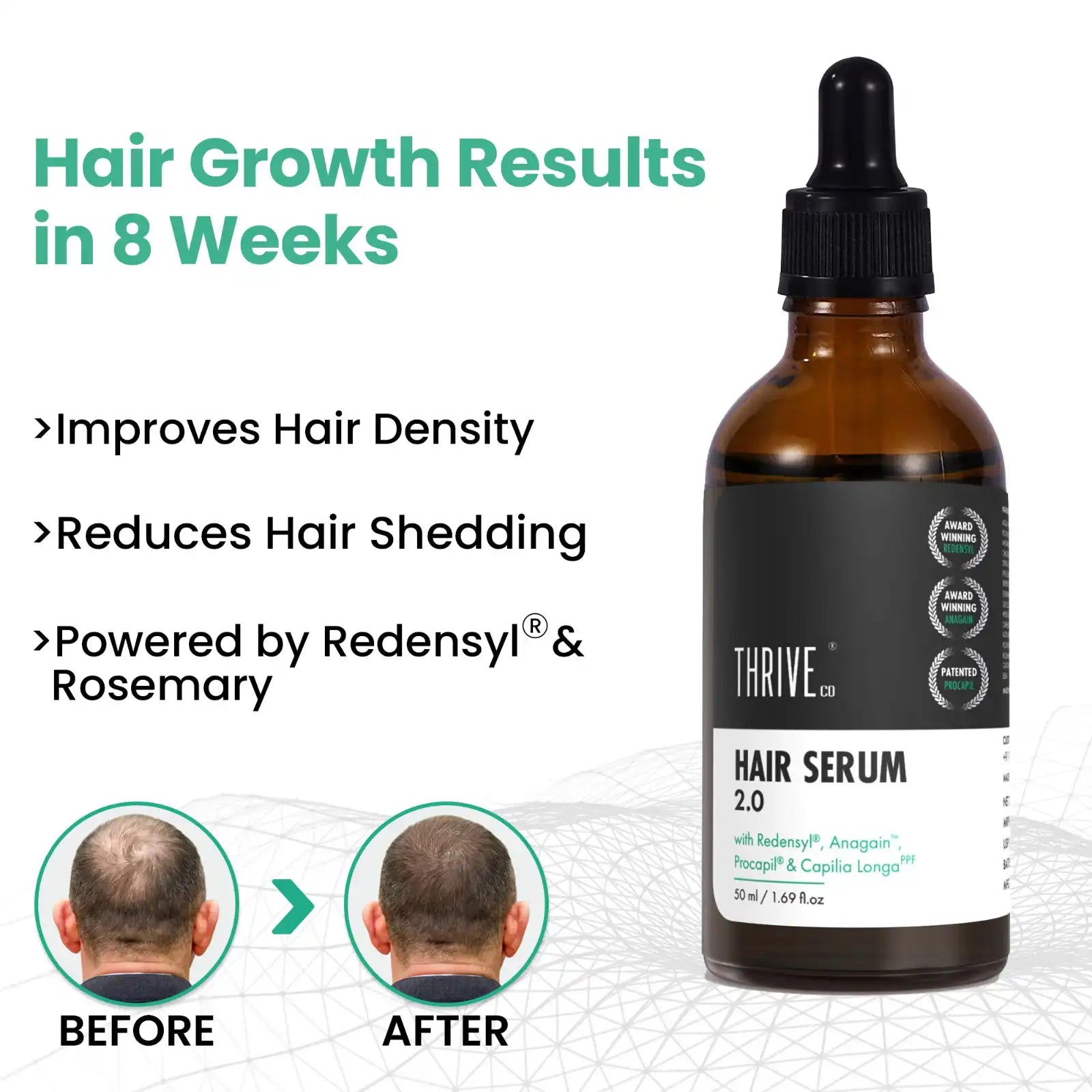 Hair Growth Serum 2.0 For Men & Women.