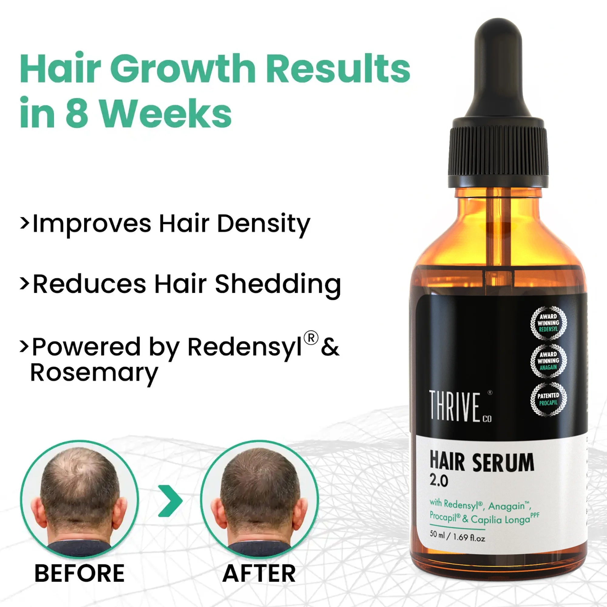 Hair Growth Serum 2.0 For Men & Women